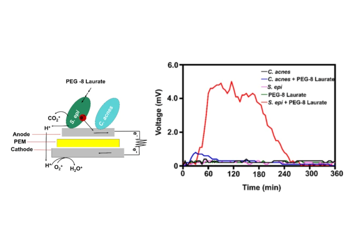 Electricity-producing Staphylococcus Epidermidis Counteracts Cutibacterium Acnes